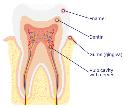 MIG400_Toothache_Tooth_Anatomy_dentin_enamel_pulp_gingiva 